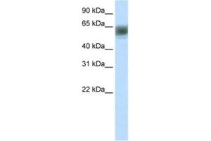 Western Blotting (WB) image for anti-AT Rich Interactive Domain 3B (BRIGHT-Like) (ARID3B) antibody (ABIN2460904)