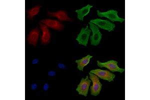 ABIN6258428 and ABIN6275047 staining Hela cells by IF/ICC. (NT5C1A anticorps  (Internal Region))