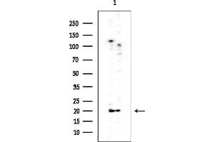 Western blot analysis of lysates from Rat testis, using DIABLO Mouse Monoclonal Antibody at 1/1000 dilution.
