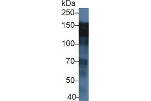 Detection of EGFR in Human MCF7(3 µL) cell lysate using Polyclonal Antibody to Epidermal Growth Factor Receptor (EGFR)