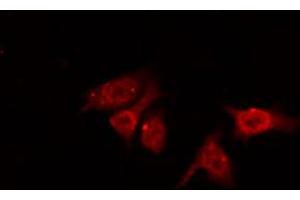 ABIN6267468 staining NIH-3T3 by IF/ICC. (CDC25B anticorps  (pSer353))