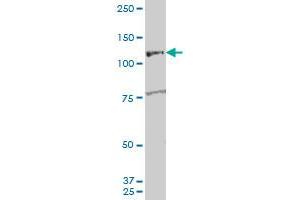 ARHGEF1 polyclonal antibody (A01), Lot # 060726QCS1 Western Blot analysis of ARHGEF1 expression in K-562 .