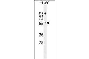 Western blot analysis in HL-60 cell line lysates (35ug/lane). (FBXW11 anticorps  (AA 168-196))