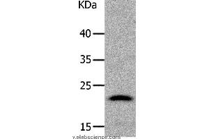 Western blot analysis of Human liver cancer tissue, using LCN2 Polyclonal Antibody at dilution of 1:1050 (Lipocalin 2 anticorps)