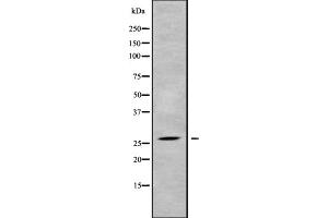 Western blot analysis of PLUNC using 293 whole cell lysates (BPIFA1 anticorps  (Internal Region))