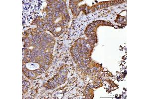 IHC analysis of Septin 2/SEPTIN2 using anti-Septin 2/SEPTIN2 antibody (ABIN7599275). (Septin 2 anticorps  (AA 1-326))