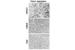 Immunocytochemical analysis of Prdm2 in adenovirus-transduced tumor cells. (PRDM2 anticorps  (AA 245-573))
