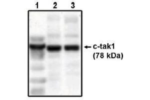 Image no. 1 for anti-MAP/microtubule Affinity-Regulating Kinase 3 (MARK3) antibody (ABIN264979) (MARK3 anticorps)