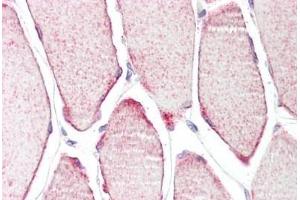 Human Skeletal Muscle: Formalin-Fixed, Paraffin-Embedded (FFPE) (TRIM54 anticorps  (AA 388-400))