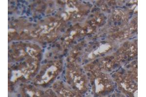 IHC-P analysis of Pig Kidney Tissue, with DAB staining. (FTH1 anticorps  (AA 1-181))