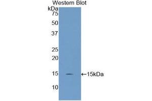 Western Blotting (WB) image for anti-Uncoupling Protein 2 (Mitochondrial, Proton Carrier) (UCP2) (AA 99-216) antibody (ABIN1175764)