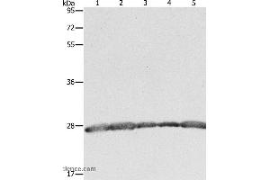 Western blot analysis of Hela, 293T and MCF7 cell, human fetal brain tissue and Jurkat cell, using PRDX3 Polyclonal Antibody at dilution of 1:800 (Peroxiredoxin 3 anticorps)