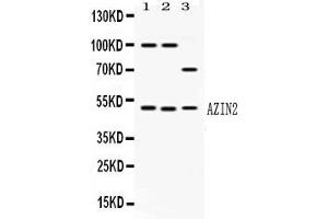 Western blot analysis of AZIN2 expression in rat brain extract ( Lane 1), mouse brain extract ( Lane 2) and HELA whole cell lysates ( Lane 3). (ADC anticorps  (AA 111-301))