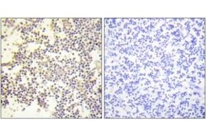 Immunohistochemistry analysis of paraffin-embedded human tonsil, using Neutrophil Cytosol Factor 1 (Phospho-Ser328) Antibody. (NCF1 anticorps  (pSer328))