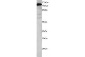Image no. 1 for anti-Maternal Embryonic Leucine Zipper Kinase (MELK) (AA 639-651) antibody (ABIN290640) (MELK anticorps  (AA 639-651))