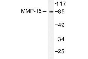Image no. 1 for anti-Matrix Metallopeptidase 15 (Membrane-inserted) (MMP15) antibody (ABIN265526)