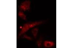 ABIN6277078 staining  Hela cells by IF/ICC.