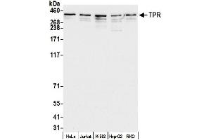 anti-Nucleoprotein TPR (TPR) (AA 1650-1700) antibody
