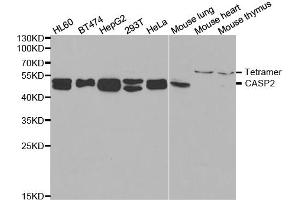 Western blot analysis of extracts of various cell lines, using CASP2 antibody. (Caspase 2 anticorps)
