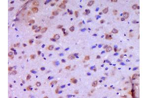 Paraformaldehyde-fixed, paraffin embedded Mouse brain Antigen retrieval by boiling in sodium citrate buffer (pH6.