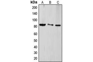Western blot analysis of TLE4 expression in HeLa (A), Jurkat (B), HEK293T (C) whole cell lysates. (TLE4 anticorps  (Center))