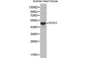 Western Blotting (WB) image for anti-8-Oxoguanine DNA Glycosylase (OGG1) (AA 1-345) antibody (ABIN3021937)