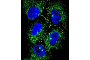 Confocal immunofluorescent analysis of ADH7 Antibody (C-Term) with NCI-H460 cell followed by Alexa Fluor® 488-conjugated goat anti-rabbit lgG (green).