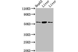 Western Blot Positive WB detected in: HepG2 whole cell lysate, Rat liver tissue, Mouse liver tissue All lanes: GPT antibody at 4. (ALT anticorps  (AA 2-496))