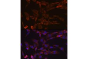Immunofluorescence analysis of NIH-3T3 cells using Inhibin beta A (INHBA) (INHBA) Rabbit mAb (ABIN7267870) at dilution of 1:100 (40x lens).