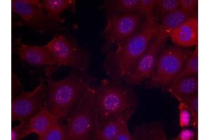 Immunofluorescence staining of methanol-fixed MCF cells using Phospho-ESR1-S167 antibody. (Estrogen Receptor alpha anticorps  (pSer167))
