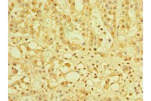 Immunohistochemistry of paraffin-embedded human adrenal gland tissue using ABIN7175978 at dilution of 1:100