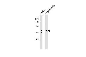 Western blot analysis of lysates from Hela cell line and human placenta tissue lysate (from left to right), using IDH3B Antibody at 1:1000 at each lane. (IDH3B anticorps  (N-Term))