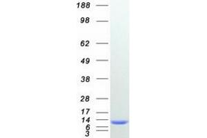 Validation with Western Blot