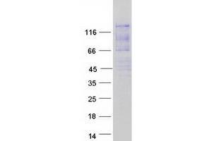 Validation with Western Blot