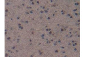 DAB staining on IHC-P; Samples: Mouse Brain Tissue (NPPC anticorps  (AA 30-126))
