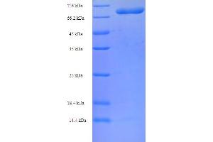 SDS-PAGE (SDS) image for Chaperonin Containing TCP1, Subunit 2 (Beta) (CCT2) (AA 2-535) protein (His-SUMO Tag) (ABIN5709225)