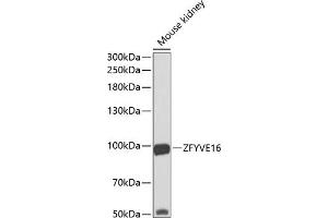 Western blot analysis of extracts of mouse kidney, using ZFYVE16 antibody (ABIN6129169, ABIN6150439, ABIN6150441 and ABIN6223717) at 1:1000 dilution.