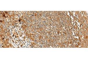 Immunohistochemistry of paraffin-embedded Human tonsil tissue using METTL17 Polyclonal Antibody at dilution of 1:60(x200)