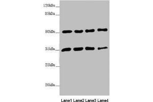 Western blot All lanes: MTX1 antibody at 3. (Metaxin 1 anticorps  (AA 217-466))