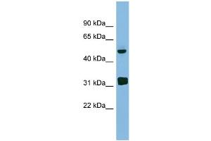 WB Suggested Anti-LYAR Antibody Titration: 0. (LYAR anticorps  (Middle Region))