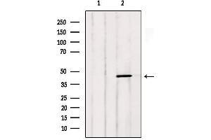 Western blot analysis of extracts from Mouse cancer, using LTBR Antibody. (LTBR anticorps  (N-Term))