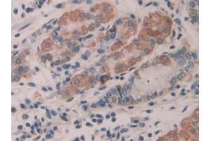 Detection of IL35 in Human Stomach Tissue using Polyclonal Antibody to Interleukin 35 (IL35)