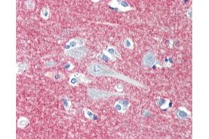 Anti-CD172A / SIRPA antibody IHC staining of human brain, cortex.