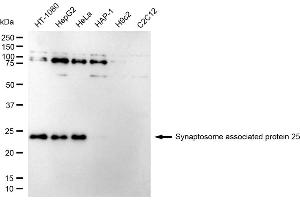 Western blotting analysis using Synaptosome associated protein 25 antibody (ABIN7800487).