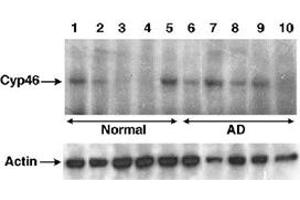 Western blot analysis of CYP46A1 in human brain lysates using CYP46A1 polyclonal antibody .