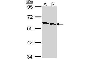 WB Image Sample (30 ug of whole cell lysate) A: Hep G2 , B: Raji 7. (CCT2 anticorps)