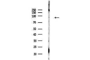 Western blot analysis of lysates from PC12 cells(heat-shock,45 min treatment), using Phospho-MSK1 (Ser360) Antibody at 1/1000 dilution.