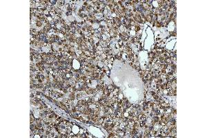 IHC analysis of AGPS using anti-AGPS antibody (ABIN7600146). (AGPS anticorps  (AA 154-658))