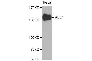Western blot analysis of extracts of HeLa cells, using ABL1 antibody (ABIN5970109) at 1/1000 dilution. (ABL1 anticorps  (C-Term))