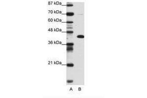 Image no. 1 for anti-Zinc Finger and BTB Domain Containing 25 (ZBTB25) (AA 181-230) antibody (ABIN6736153) (ZBTB25 anticorps  (AA 181-230))